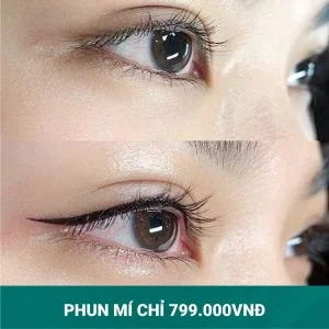 phun-mi-mo-trong-xam-mi-mat-gia-bao-nhieu-tien-3-300x300